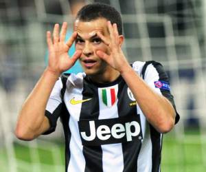 Juventus are poised to bounce back with victory against Pescara. Giovinco might have a great game.